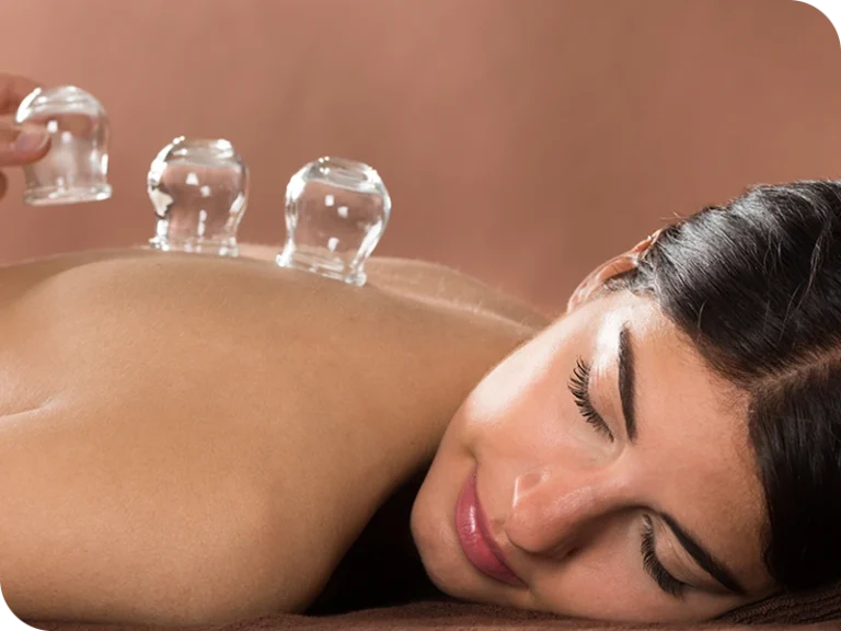 cupping