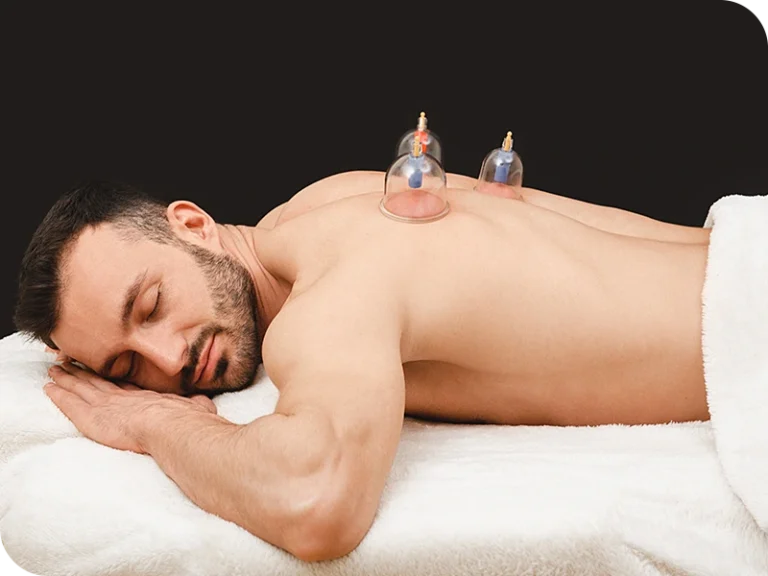 cupping