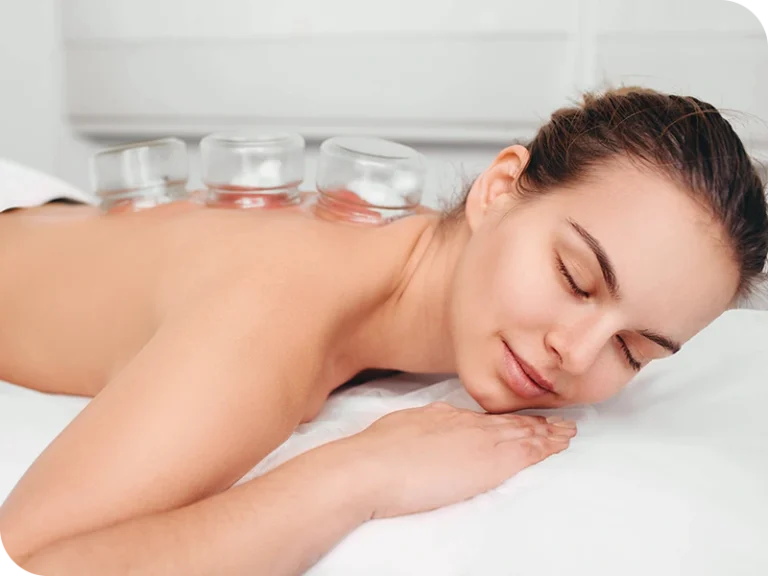 cupping